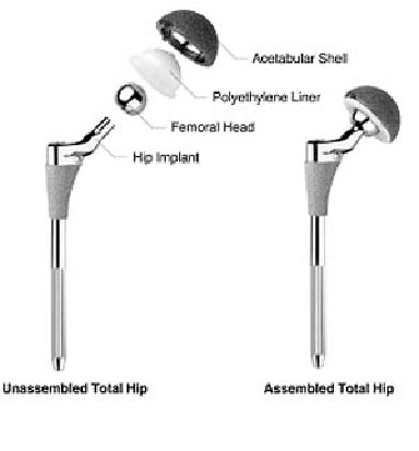 hip joint